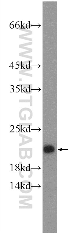 Western Blot (WB) analysis of human plasma using CLEC3B Polyclonal antibody (20311-1-AP)