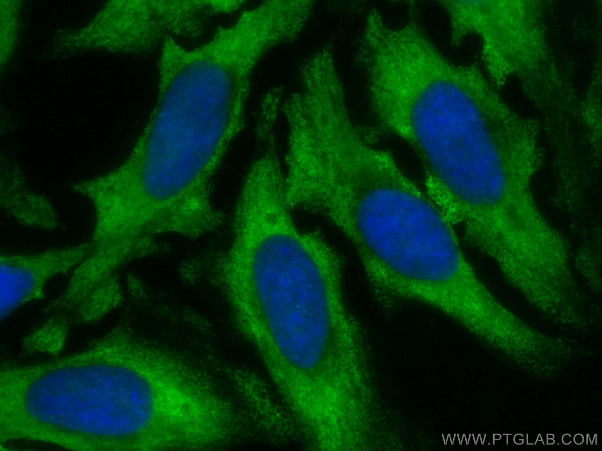 IF Staining of HeLa using CL488-20311