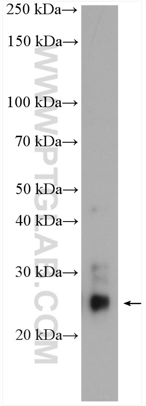 WB analysis of human peripheral blood leukocyte using 18930-1-AP