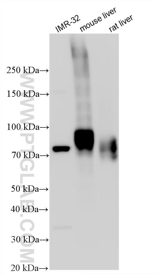 WB analysis using 34238-1-AP (same clone as 34238-1-PBS) Western Blot (WB) analysis of various lysates using CLEC4F Polyclonal antibody (34238-1-AP)