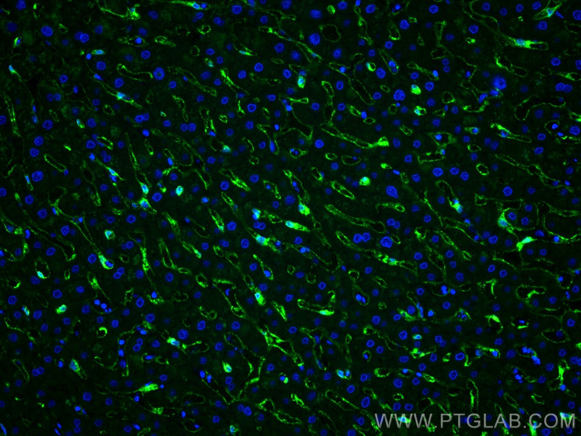 Immunofluorescence (IF) / fluorescent staining of human liver tissue using CLEC4G Polyclonal antibody (18173-1-AP)