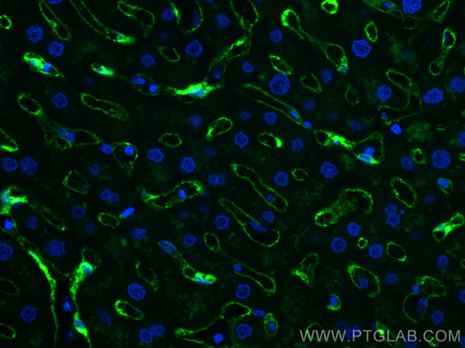 Immunofluorescence (IF) / fluorescent staining of human liver tissue using CLEC4G Polyclonal antibody (18173-1-AP)