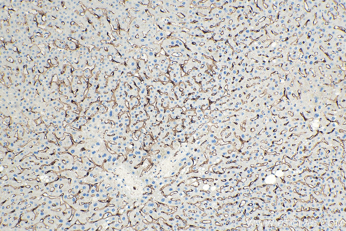 Immunohistochemistry (IHC) staining of human liver tissue using CLEC4G Polyclonal antibody (18173-1-AP)