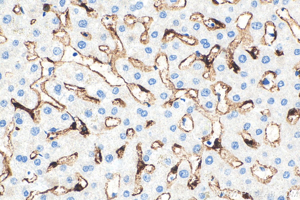 Immunohistochemistry (IHC) staining of human liver tissue using CLEC4G Polyclonal antibody (18173-1-AP)