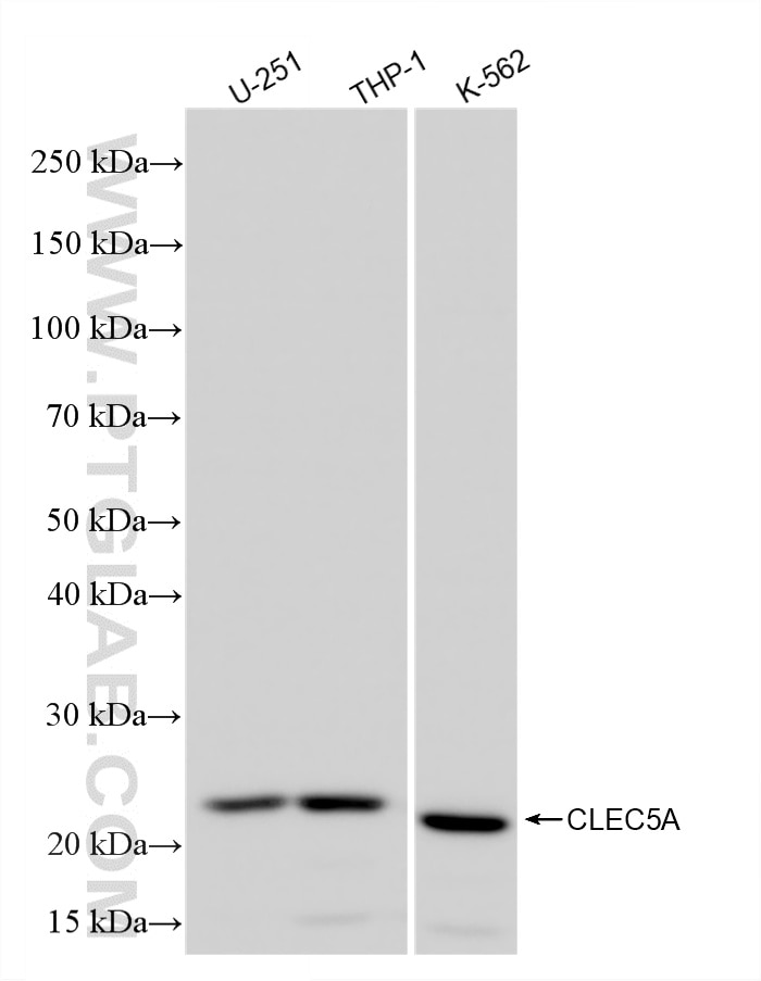 WB analysis using 86633-2-RR (same clone as 86633-2-PBS) Western Blot (WB) analysis of various lysates using CLEC5A Recombinant monoclonal antibody (86633-2-RR)