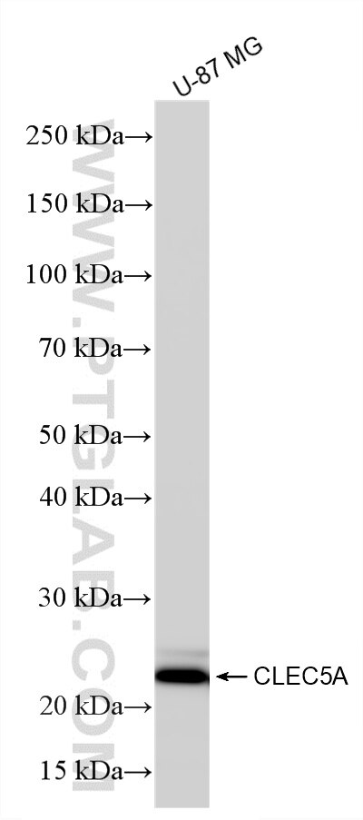 WB analysis using 86633-2-RR (same clone as 86633-2-PBS) Western Blot (WB) analysis of various lysates using CLEC5A Recombinant monoclonal antibody (86633-2-RR)