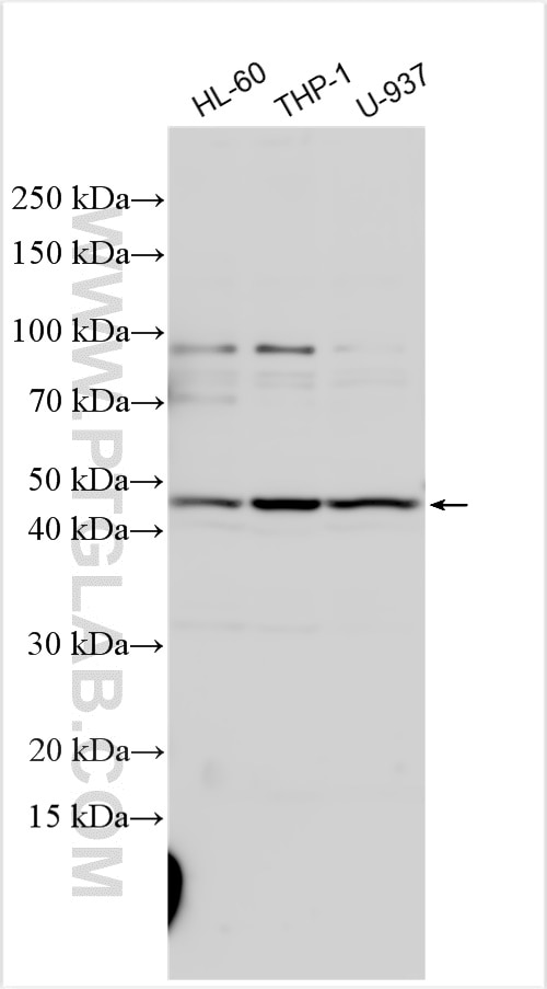 Western Blot (WB) analysis of various lysates using Dectin-1 Polyclonal antibody (22809-1-AP)