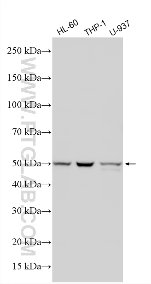 Western Blot (WB) analysis of various lysates using Dectin-1 Polyclonal antibody (22809-1-AP)