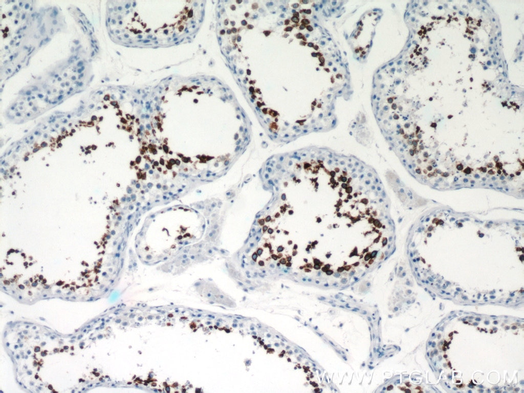 Immunohistochemistry (IHC) staining of human testis tissue using Calmegin Polyclonal antibody (12629-1-AP)