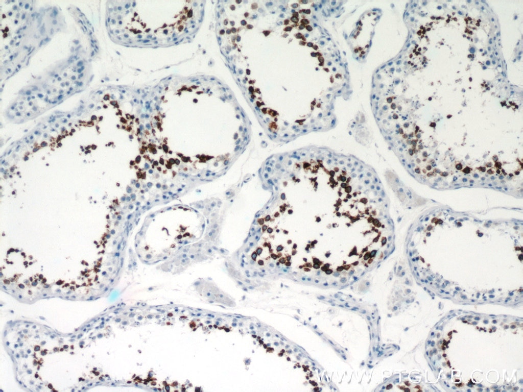 IHC staining of human testis using 12629-1-AP