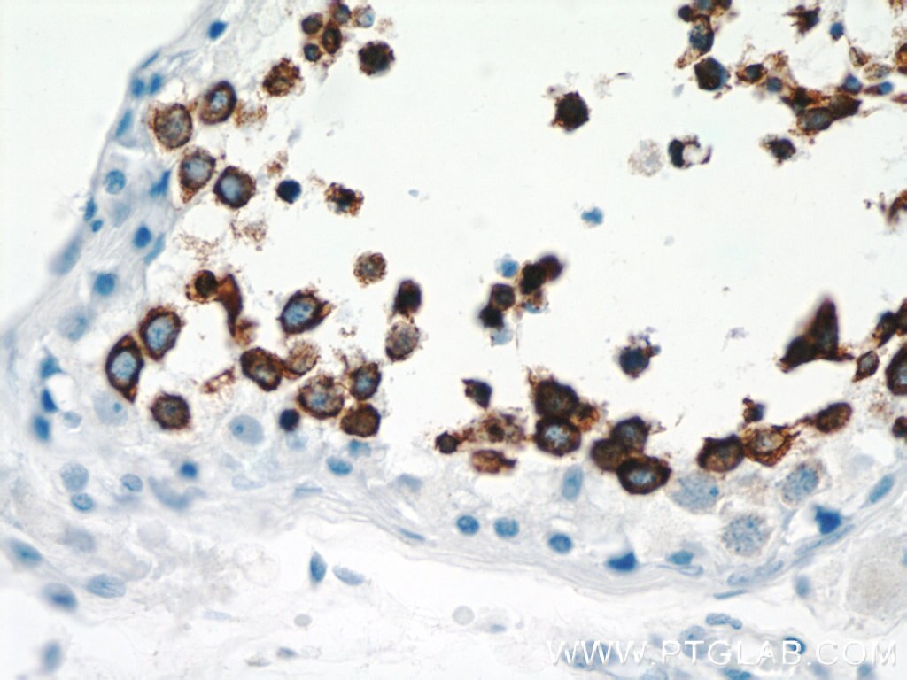 Immunohistochemistry (IHC) staining of human testis tissue using Calmegin Polyclonal antibody (12629-1-AP)