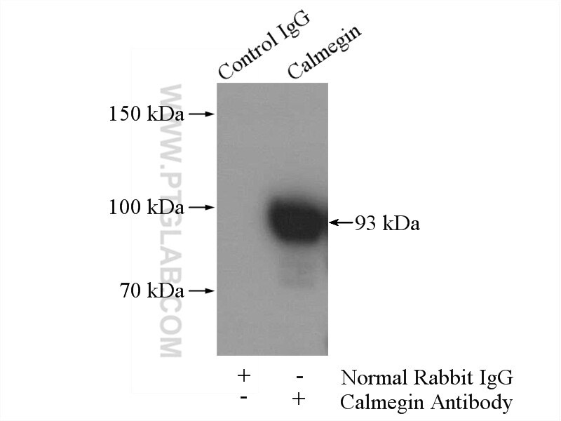 Immunoprecipitation (IP) experiment of mouse testis tissue using Calmegin Polyclonal antibody (12629-1-AP)