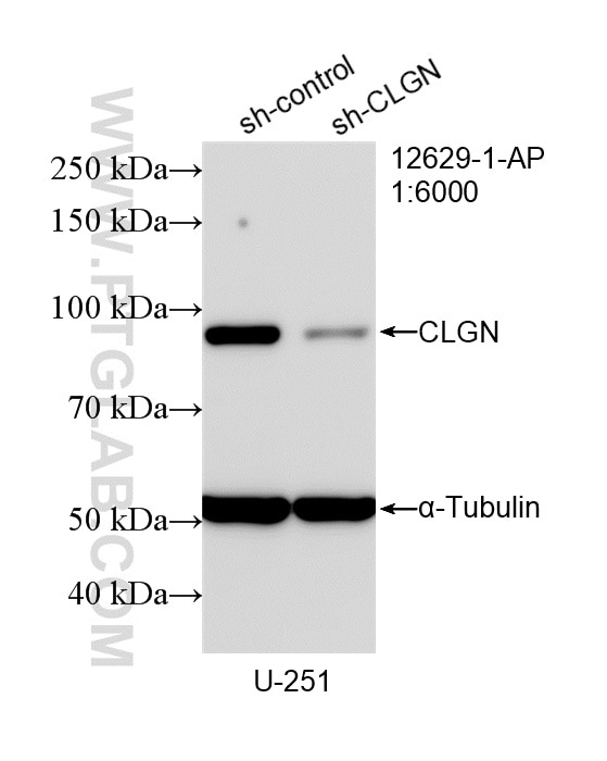 WB analysis of U-251 using 12629-1-AP Western Blot (WB) analysis of U-251 cells using Calmegin Polyclonal antibody (12629-1-AP)
