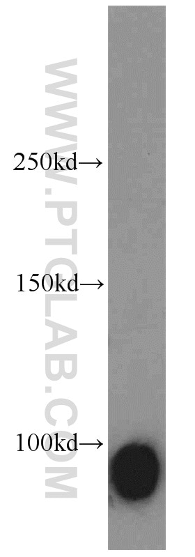 Western Blot (WB) analysis of mouse testis tissue using Calmegin Polyclonal antibody (12629-1-AP)