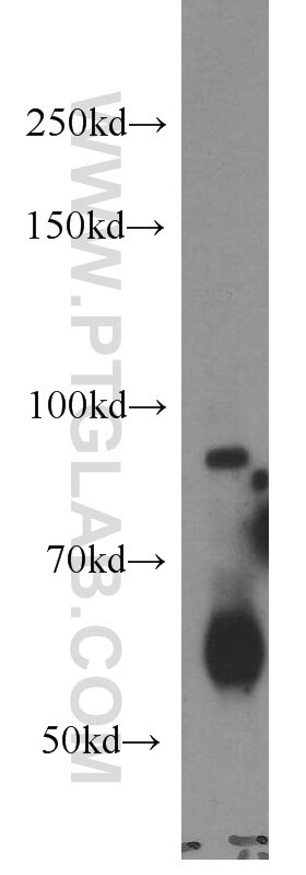 Western Blot (WB) analysis of mouse lung tissue using Calmegin Polyclonal antibody (12629-1-AP)
