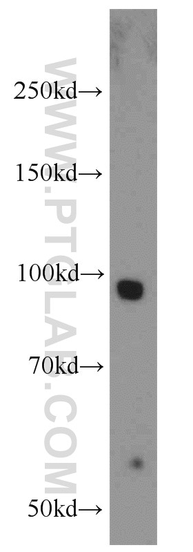 Western Blot (WB) analysis of mouse brain tissue using Calmegin Polyclonal antibody (12629-1-AP)