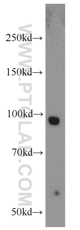 Western Blot (WB) analysis of mouse brain tissue using Calmegin Polyclonal antibody (12629-1-AP)