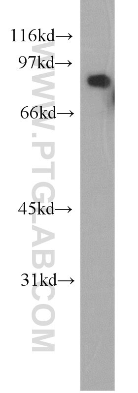 Western Blot (WB) analysis of human brain tissue using Calmegin Polyclonal antibody (12629-1-AP)