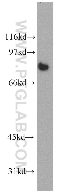 Western Blot (WB) analysis of human lung tissue using Calmegin Polyclonal antibody (12629-1-AP)