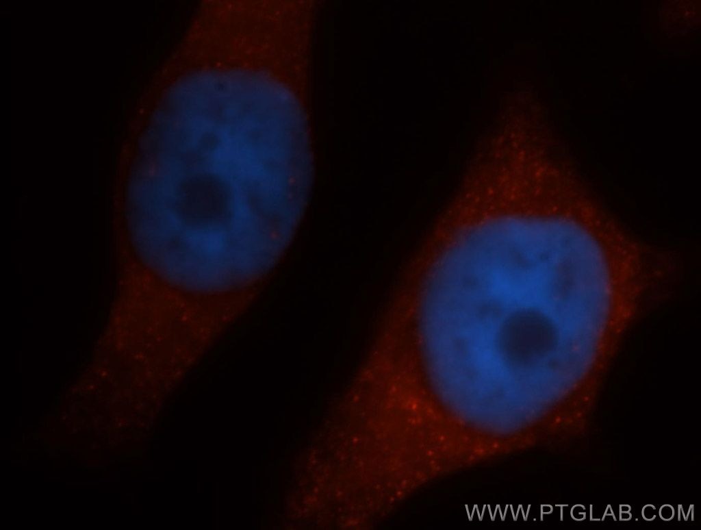 Immunofluorescence (IF) / fluorescent staining of HeLa cells using CLIC1 Polyclonal antibody (14545-1-AP)