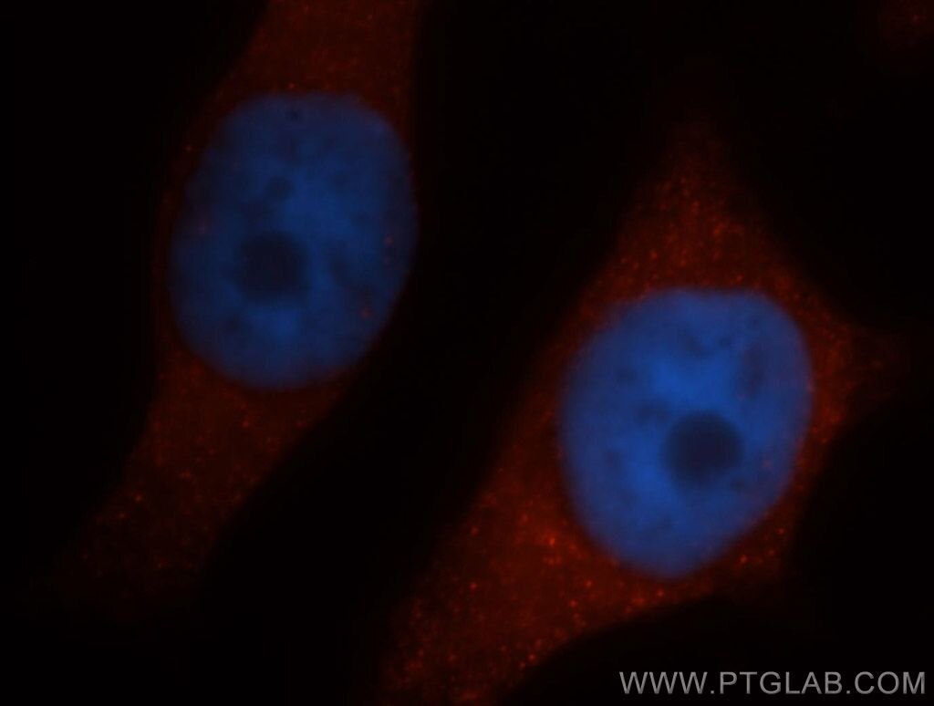 IF Staining of HeLa using 14545-1-AP