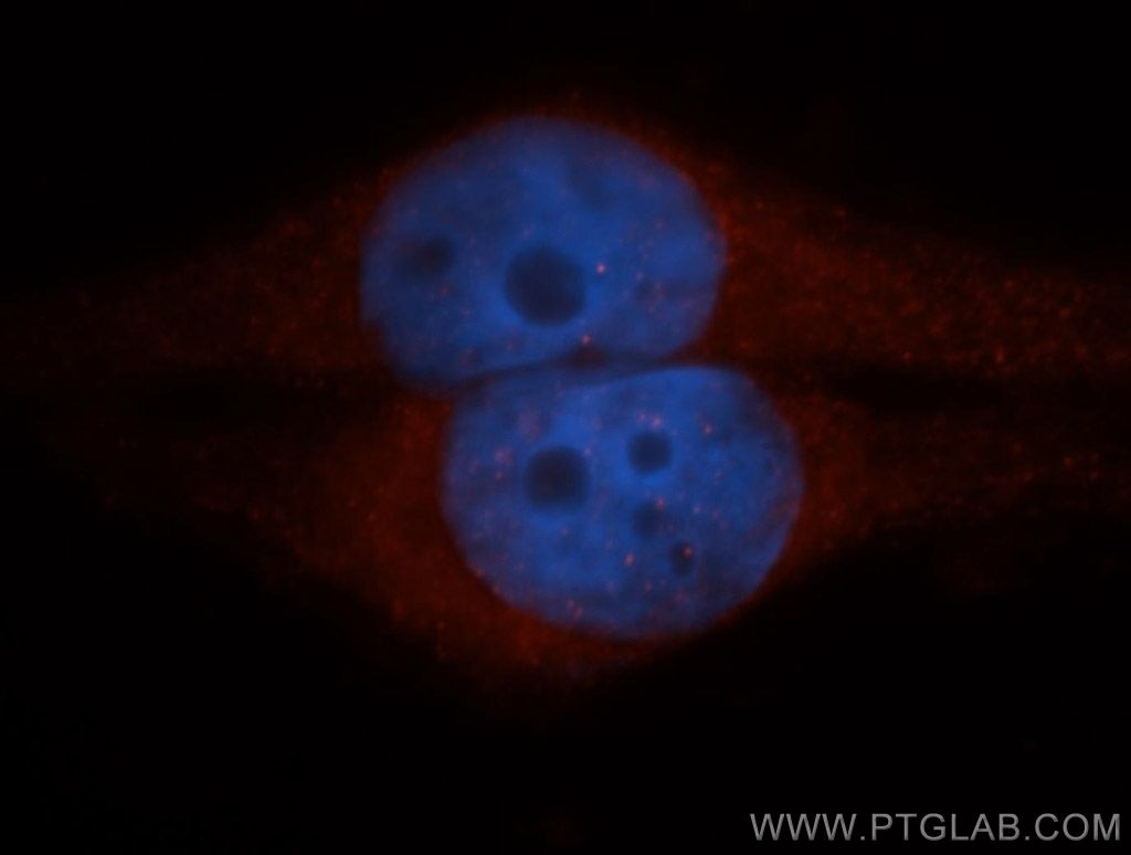Immunofluorescence (IF) / fluorescent staining of HepG2 cells using CLIC1 Polyclonal antibody (14545-1-AP)