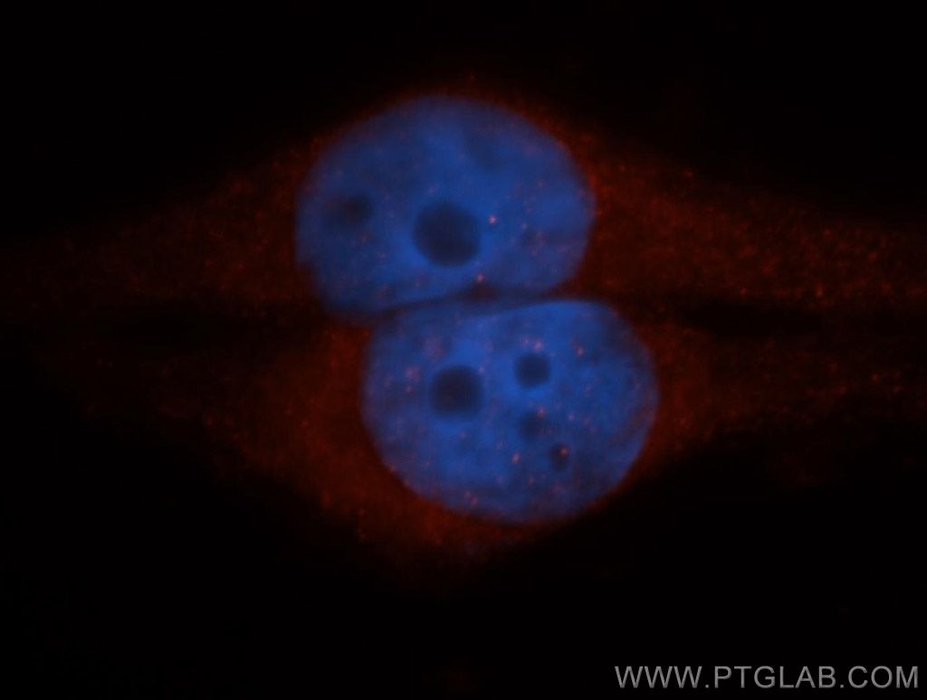 IF Staining of HepG2 using 14545-1-AP