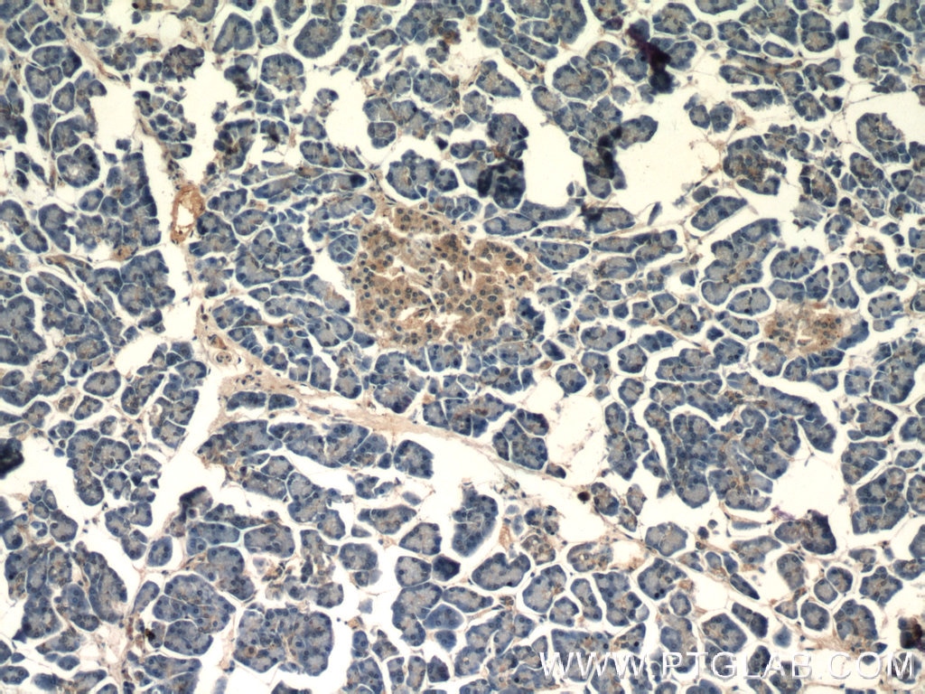 Immunohistochemistry (IHC) staining of human pancreas tissue using CLIC1 Polyclonal antibody (14545-1-AP)