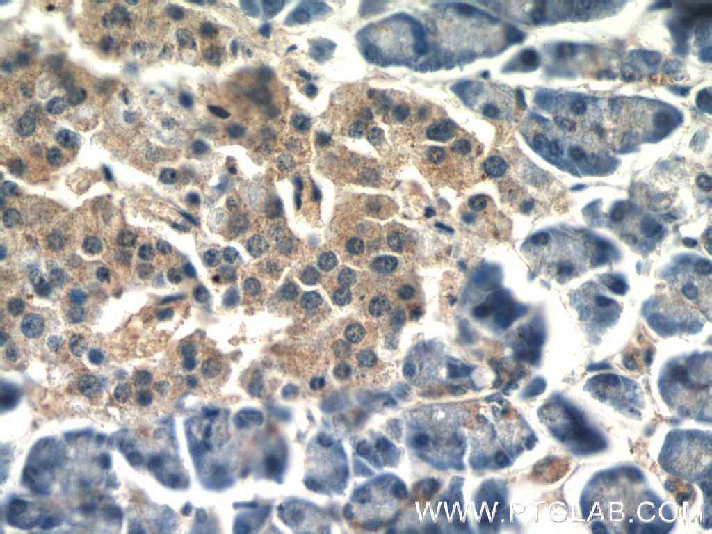 Immunohistochemistry (IHC) staining of human pancreas tissue using CLIC1 Polyclonal antibody (14545-1-AP)