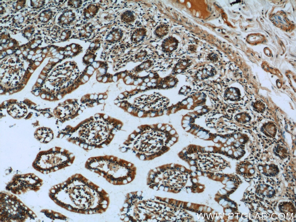 Immunohistochemistry (IHC) staining of human small intestine tissue using CLIC1 Polyclonal antibody (14545-1-AP)