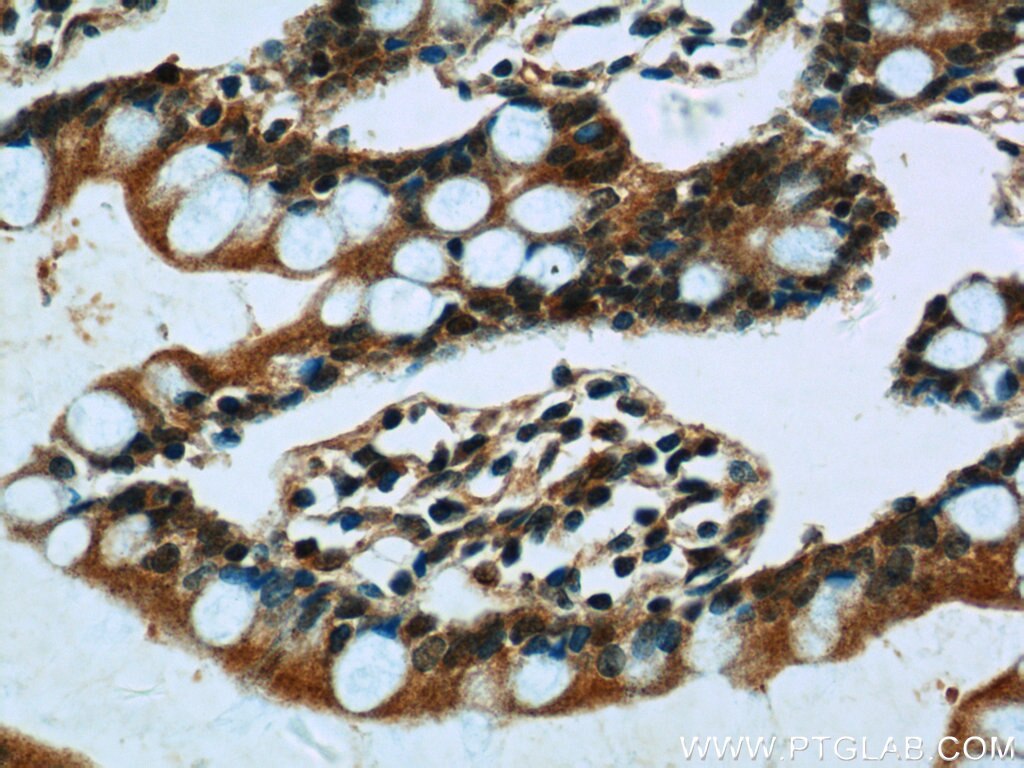 Immunohistochemistry (IHC) staining of human small intestine tissue using CLIC1 Polyclonal antibody (14545-1-AP)