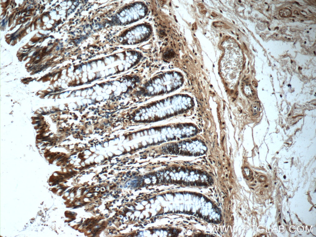 Immunohistochemistry (IHC) staining of human colon tissue using CLIC1 Polyclonal antibody (14545-1-AP)
