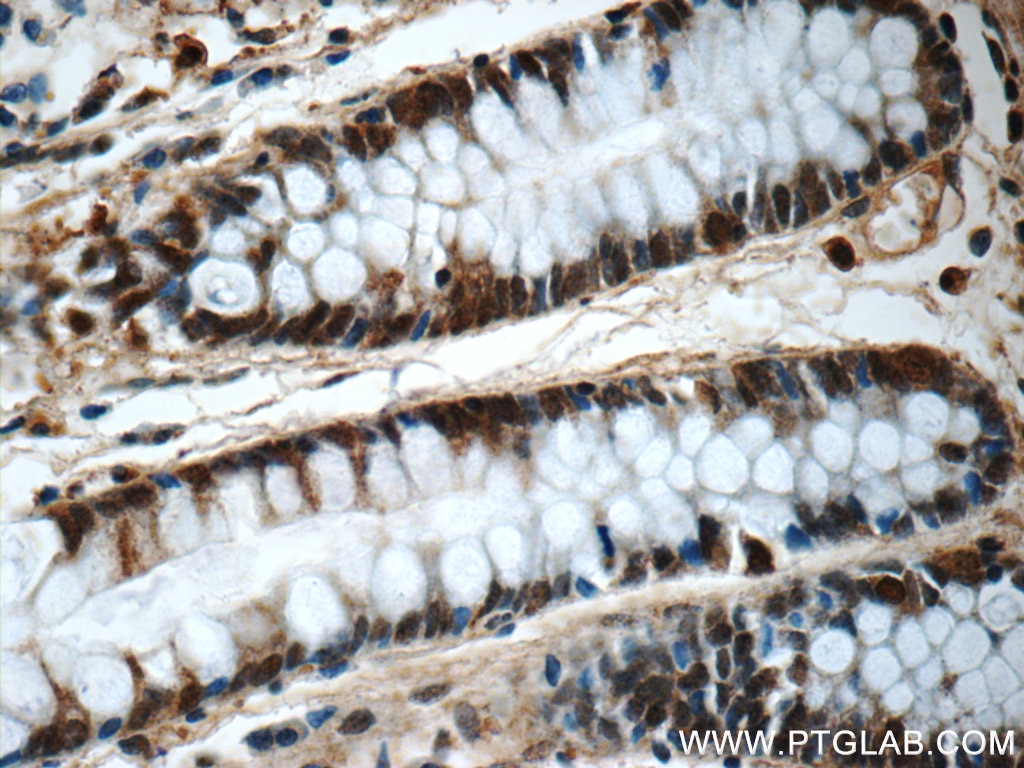 IHC staining of human colon using 14545-1-AP