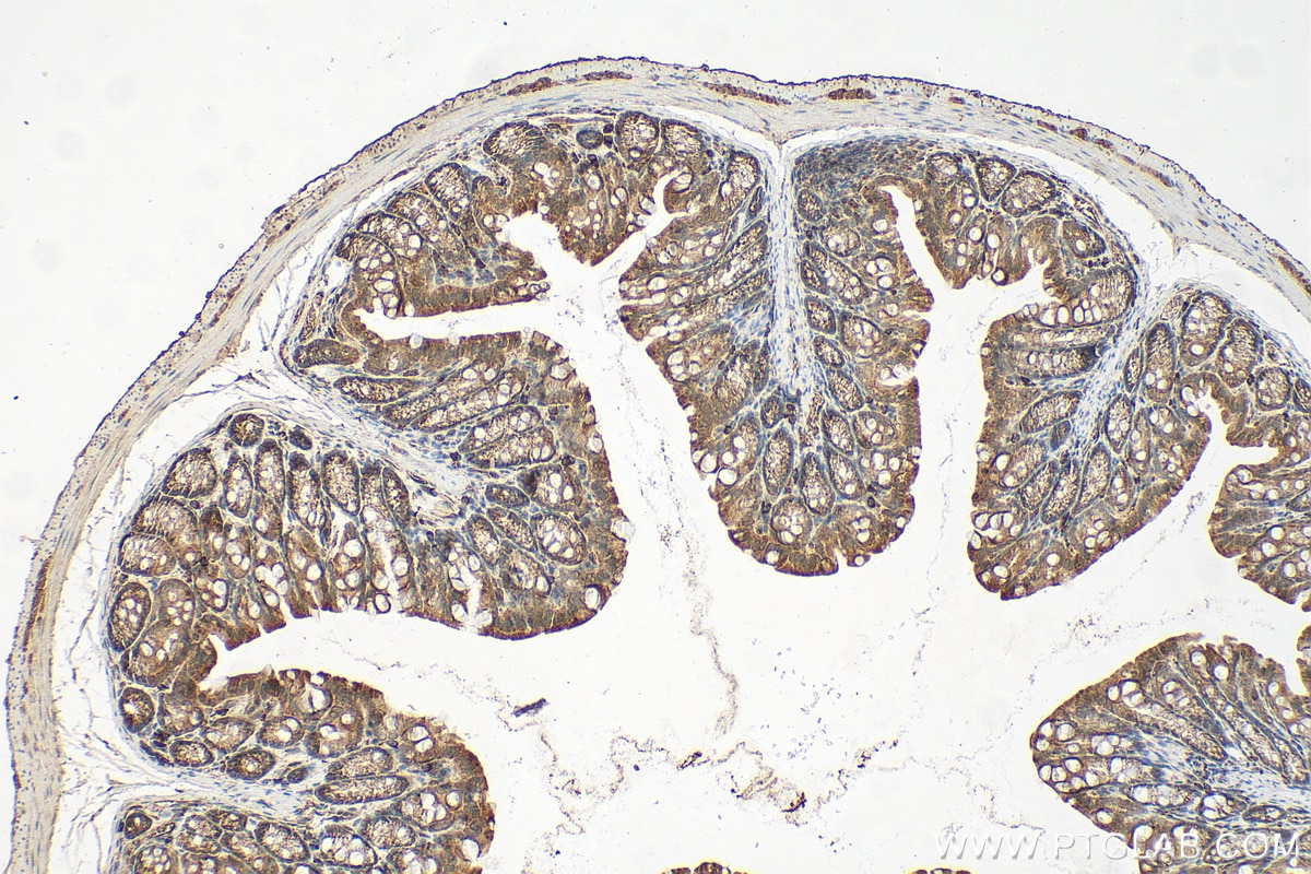 Immunohistochemistry (IHC) staining of mouse colon tissue using CLIC1 Polyclonal antibody (14545-1-AP)