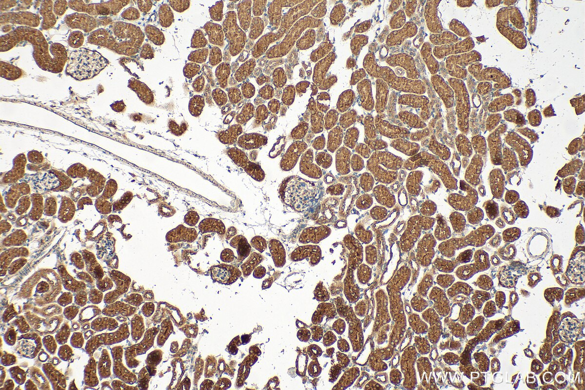 Immunohistochemistry (IHC) staining of mouse kidney tissue using CLIC1 Polyclonal antibody (14545-1-AP)