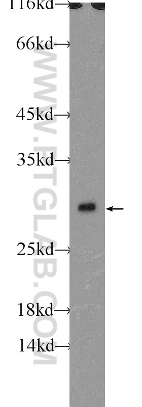 Western Blot (WB) analysis of HeLa cells using CLIC1 Polyclonal antibody (14545-1-AP)
