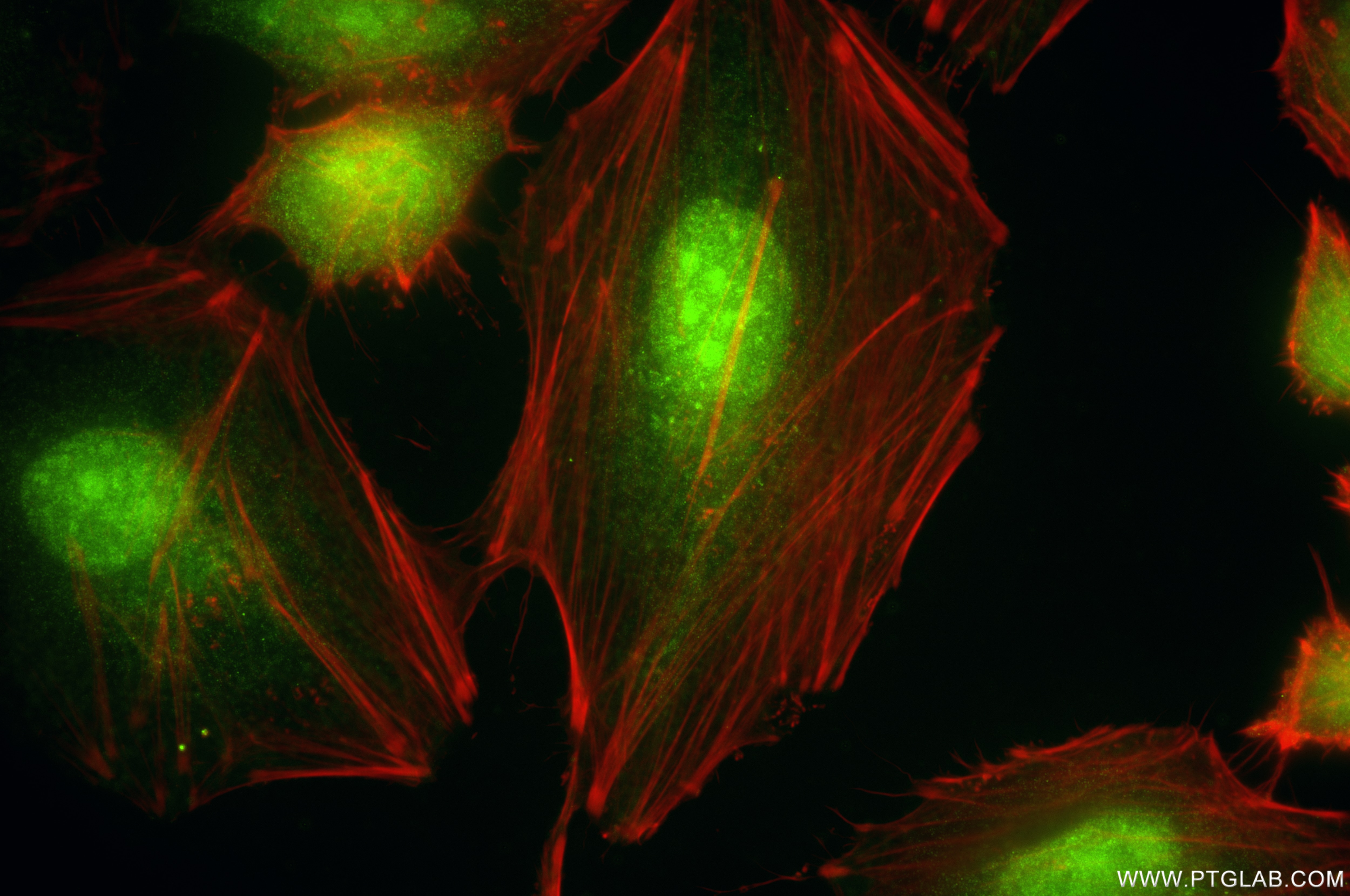 Immunofluorescence (IF) / fluorescent staining of HeLa cells using CLIC1 Recombinant antibody (85831-4-RR)