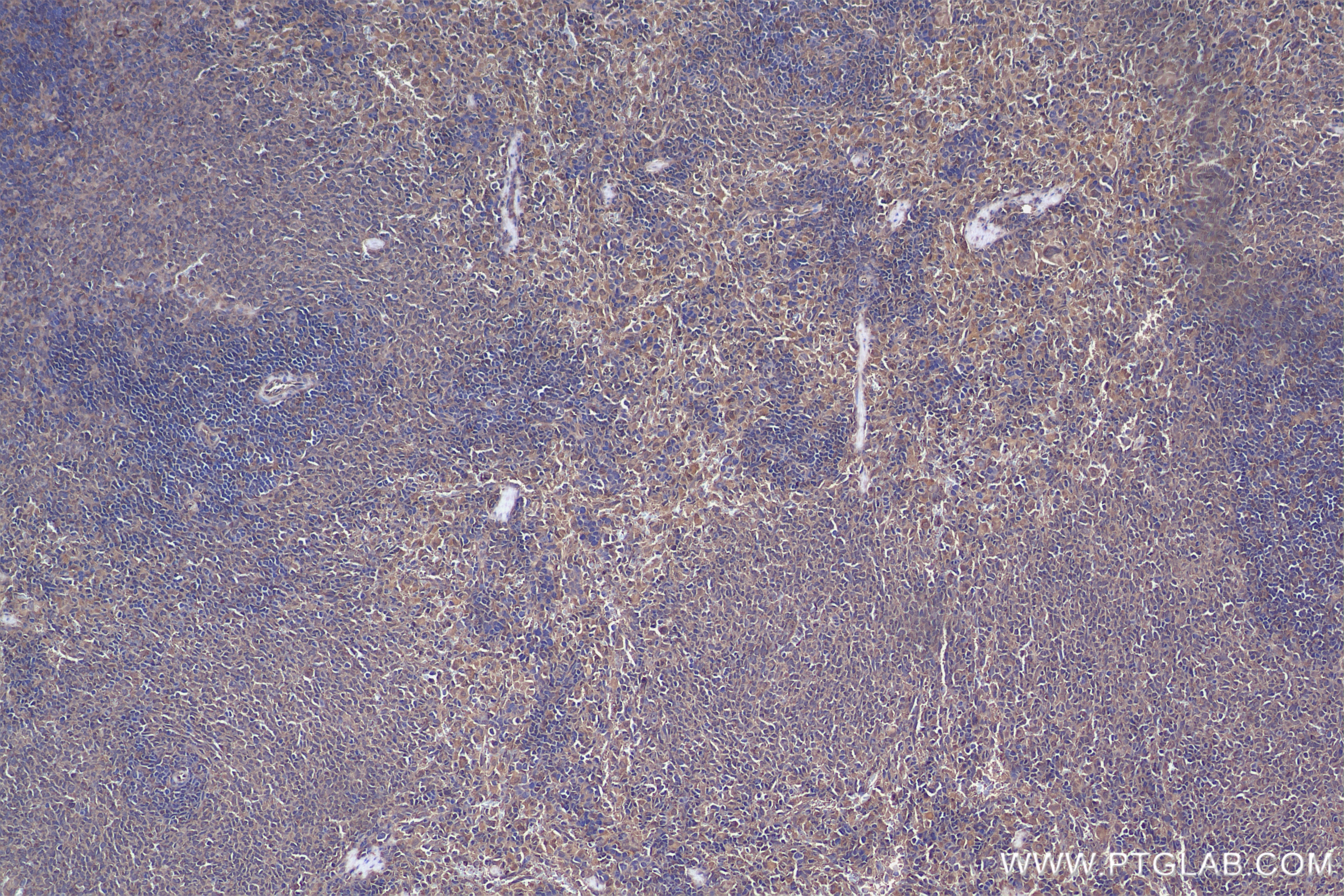 Immunohistochemistry (IHC) staining of rat spleen tissue using CLIC1 Recombinant antibody (85831-4-RR)