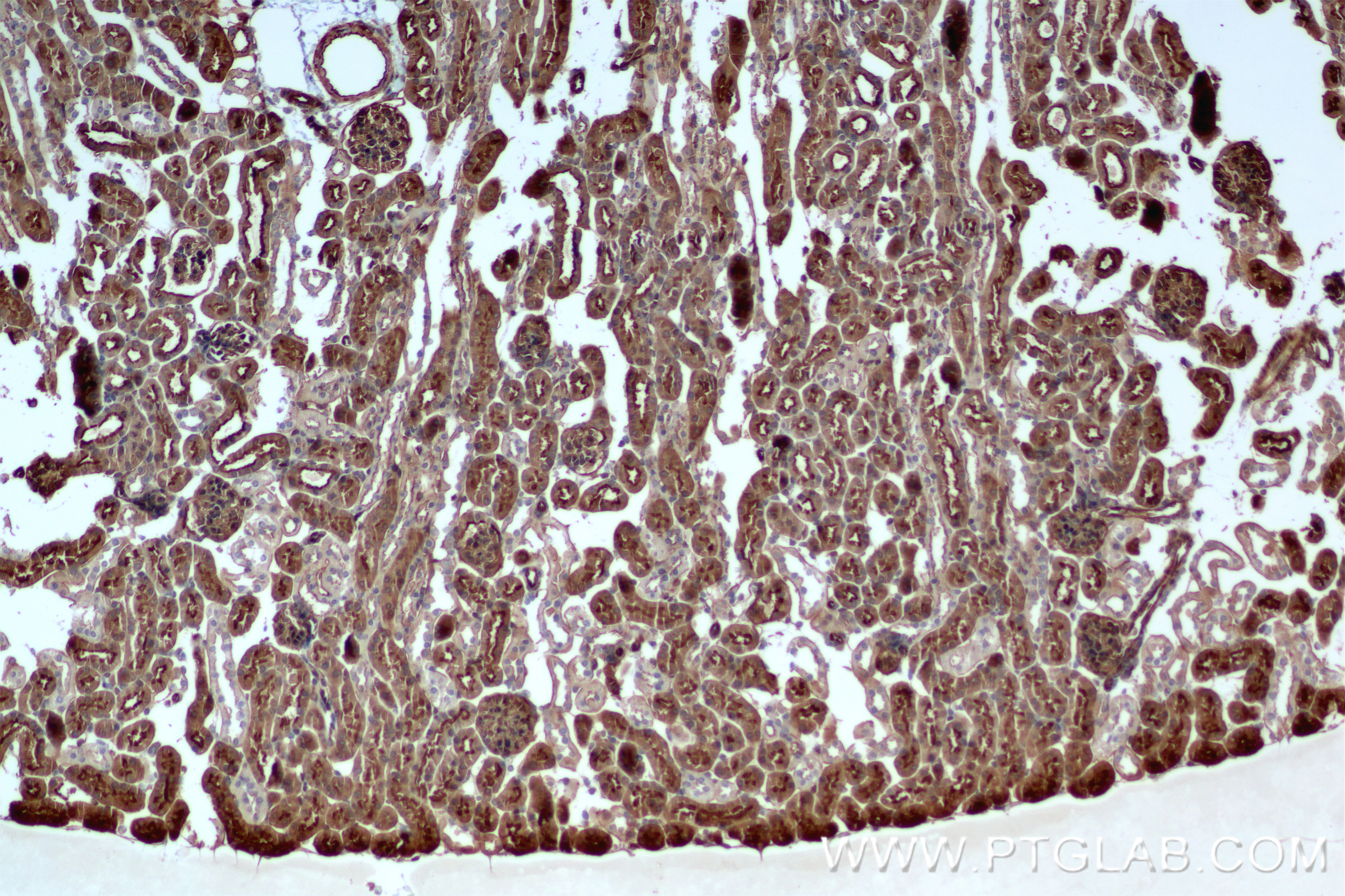 Immunohistochemistry (IHC) staining of mouse kidney tissue using CLIC1 Recombinant antibody (85831-4-RR)