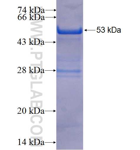 CLIC1 fusion protein Ag6049 SDS-PAGE