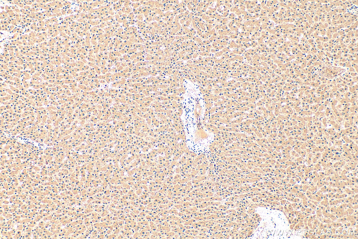 Immunohistochemistry (IHC) staining of human liver tissue using CLIC2 Polyclonal antibody (14935-1-AP)