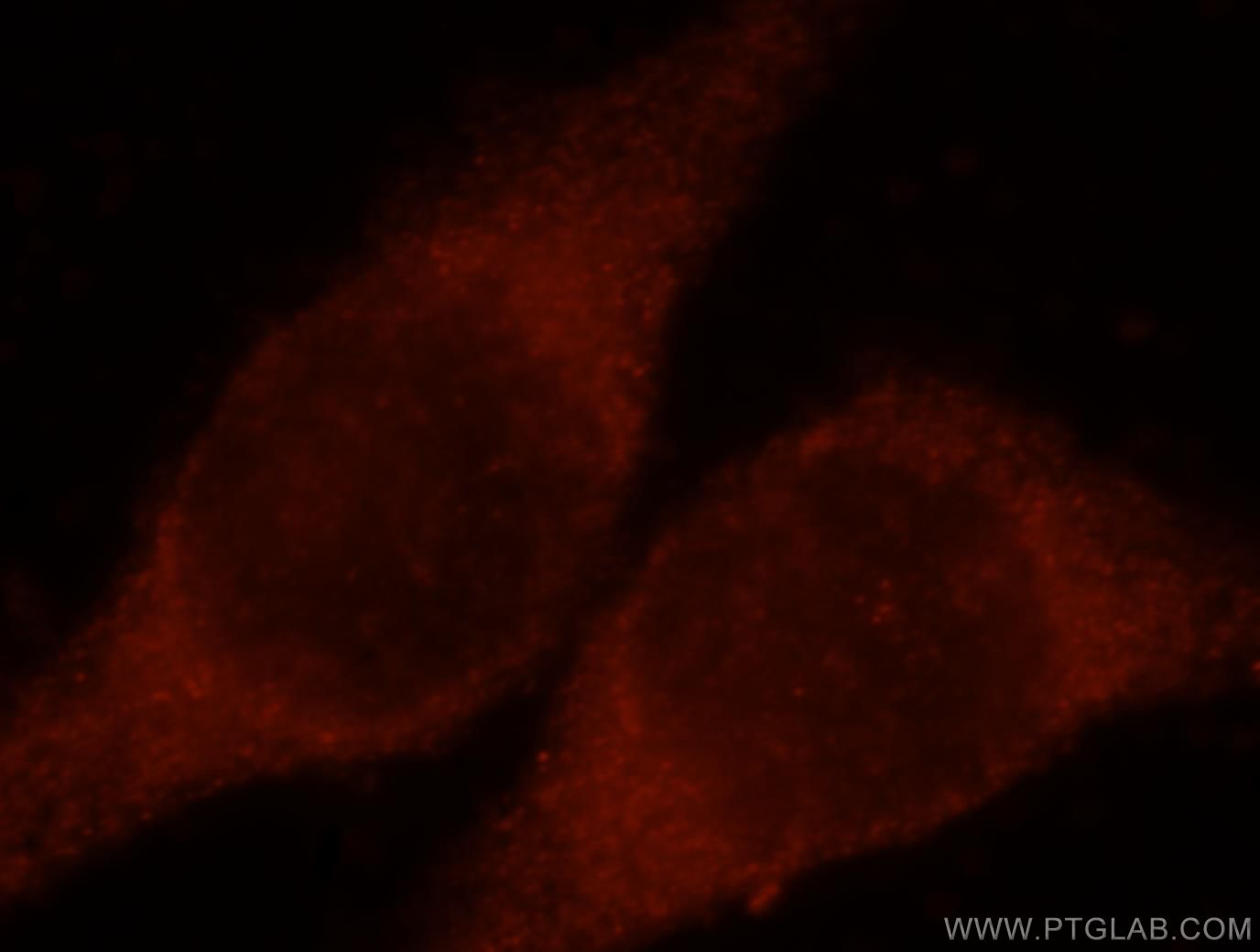 Immunofluorescence (IF) / fluorescent staining of MCF-7 cells using CLIC3 Polyclonal antibody (15971-1-AP)