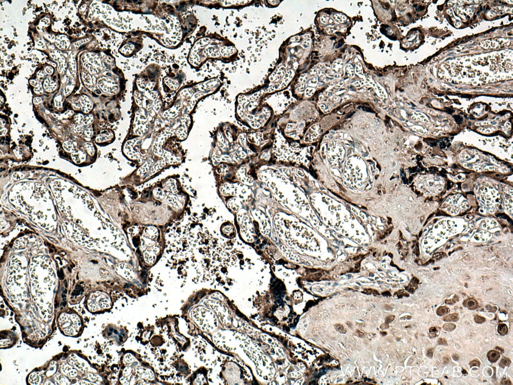 Immunohistochemistry (IHC) staining of human placenta tissue using CLIC3 Polyclonal antibody (15971-1-AP)