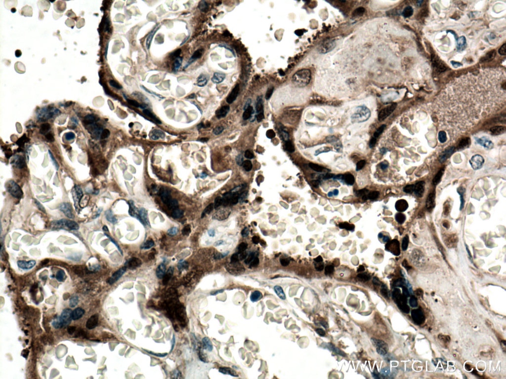 Immunohistochemistry (IHC) staining of human placenta tissue using CLIC3 Polyclonal antibody (15971-1-AP)