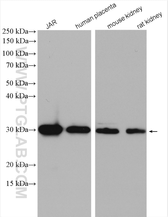Western Blot (WB) analysis of various lysates using CLIC3 Polyclonal antibody (15971-1-AP)