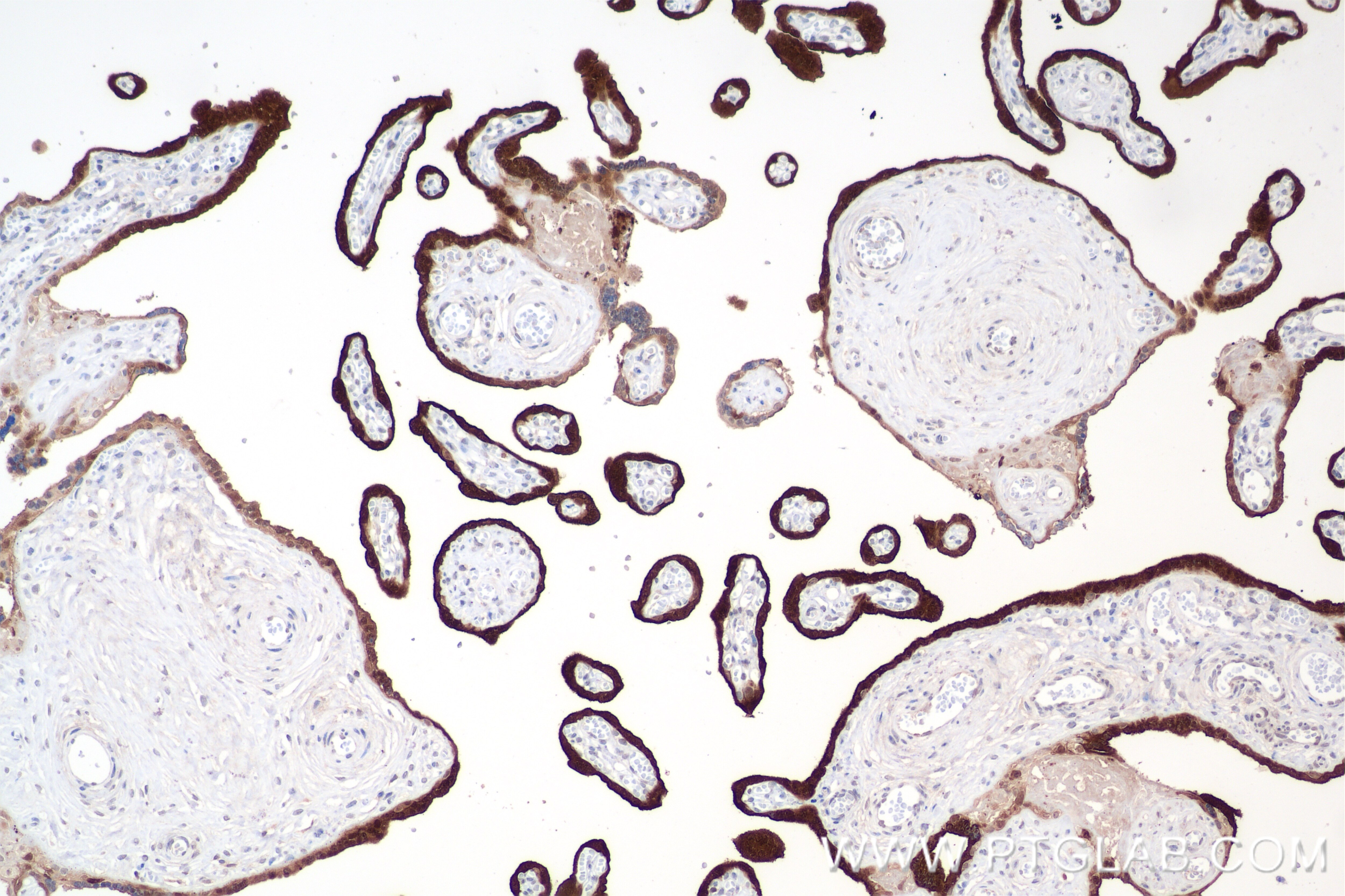 Immunohistochemistry (IHC) staining of human placenta tissue using CLIC3 Recombinant antibody (84759-4-RR)