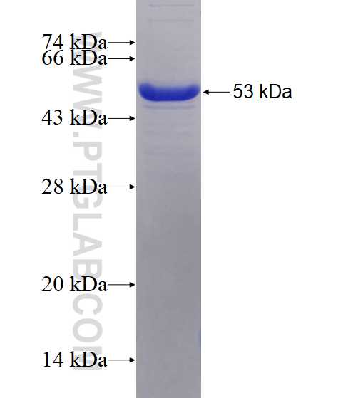 CLIC3 fusion protein Ag8757 SDS-PAGE