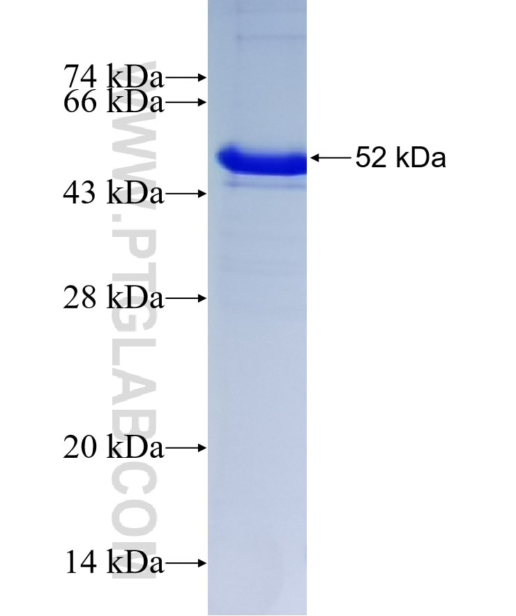 CLIC3 fusion protein Ag8757 SDS-PAGE