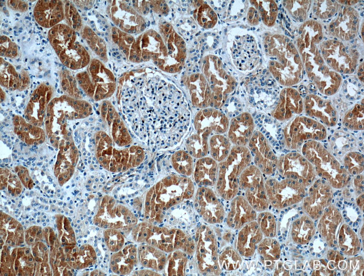Immunohistochemistry (IHC) staining of human kidney tissue using CLIC4 Polyclonal antibody (12298-2-AP)