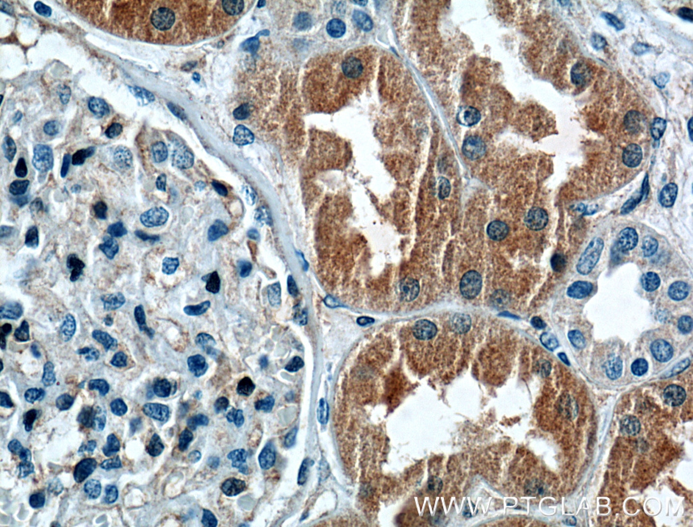 Immunohistochemistry (IHC) staining of human kidney tissue using CLIC4 Polyclonal antibody (12298-2-AP)